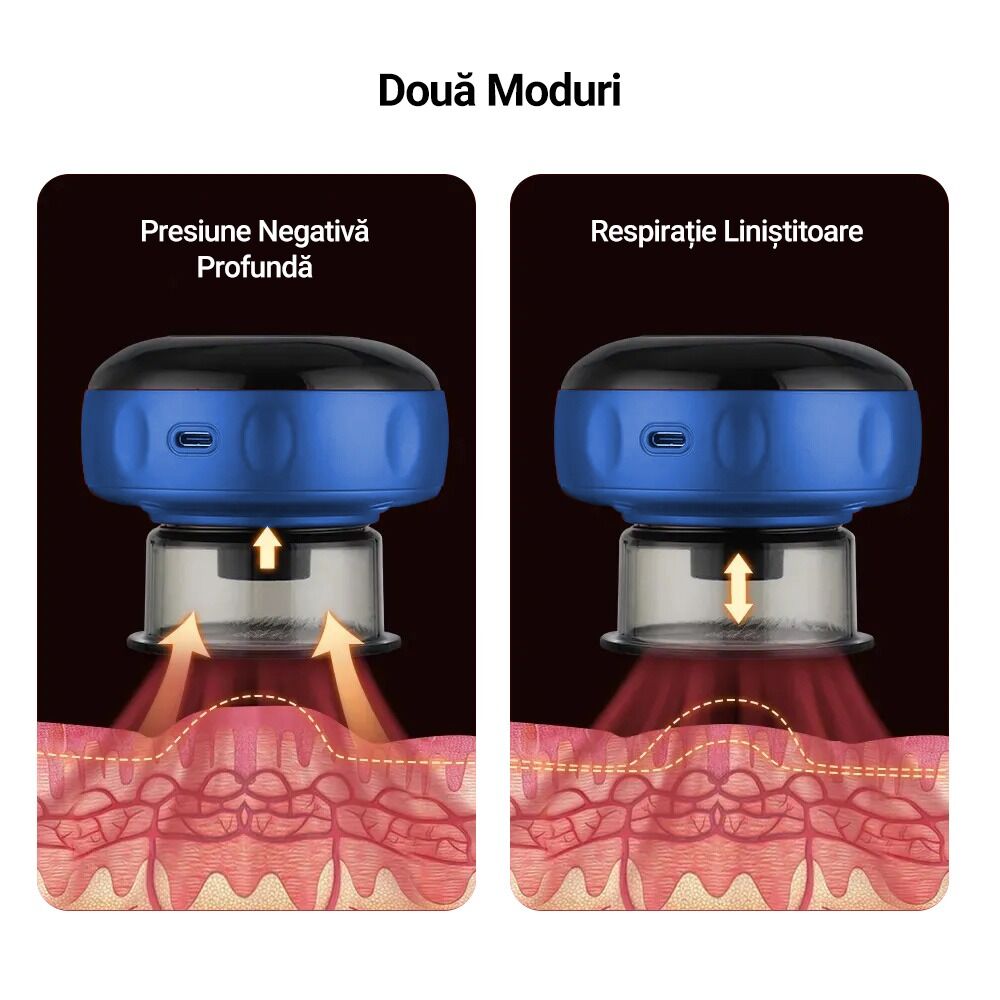 Aparat inteligent profesional de masaj cu ventuze electrice, razuire a punctului de acupunctura, pentru detoxifiere, aspirare in vid cu putere mare, compresa fierbinte pentru ameliorarea durerii, portabil, fara fir, acumulator 1200 mAh, albastru - imagine 4